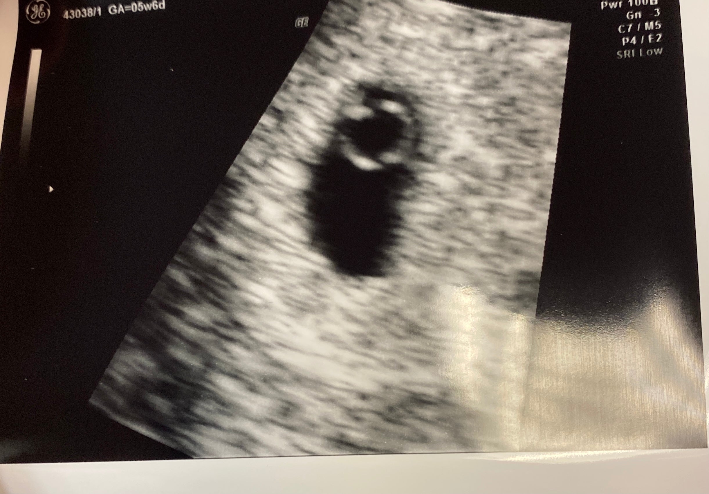 Sonogram of a Mosie Baby!