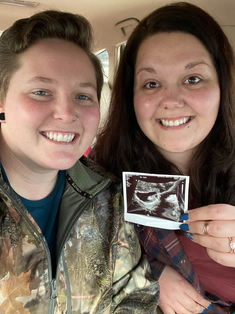 Mamas share sonogram for their baby announcement! 