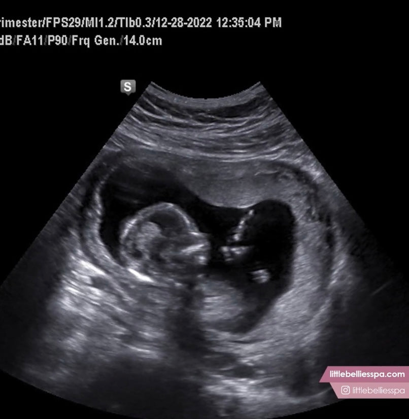 Ultrasound Image