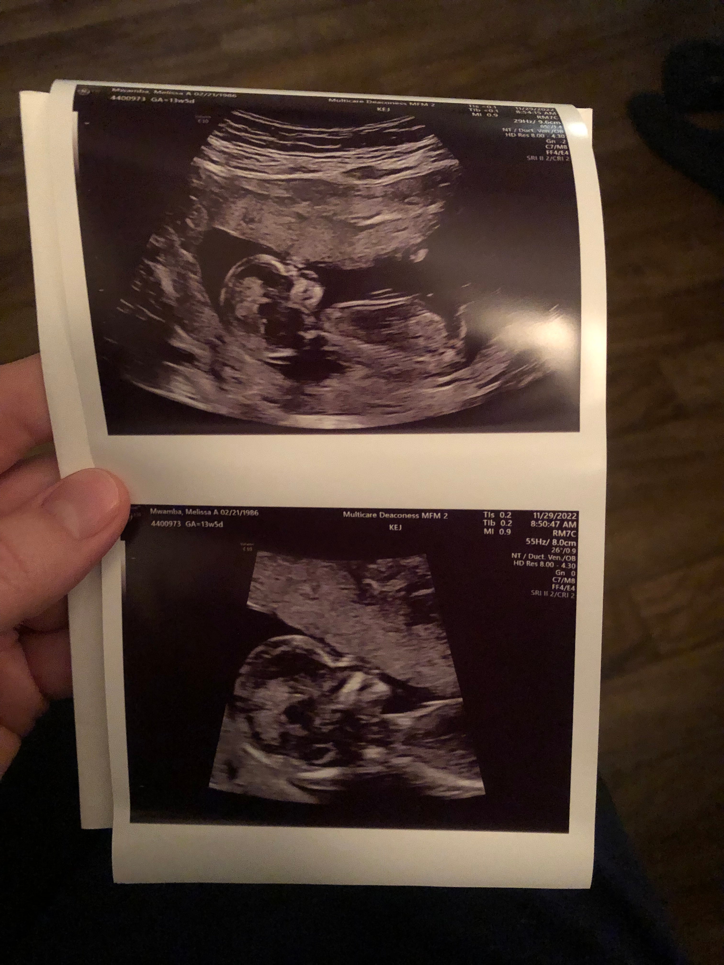 Ultrasound result