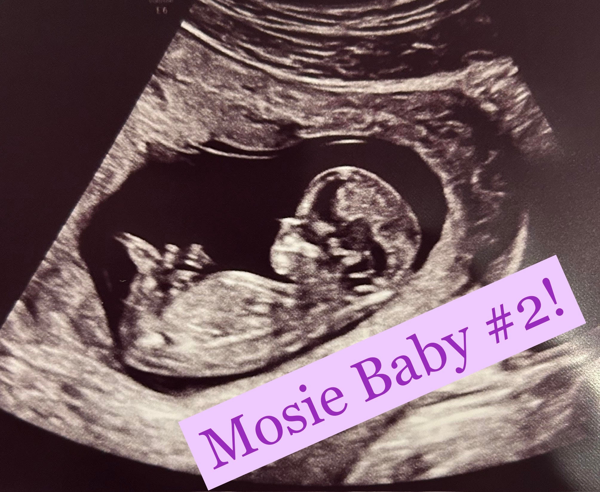 Ultrasound Image